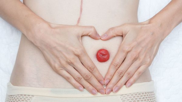 Atención al Paciente Ostomizado