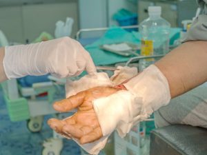 Cuidados Enfermeros en la Unidad de Quemados